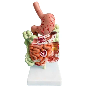 Humano Sistema Digestivo Modelo De Estômago Anatomia Do Intestino Grosso Ceco E Reto Duodeno Humana Órgãos Internos De Modelo De Estrutura